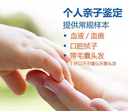 丹东可以做亲子鉴定吗，丹东办理亲子鉴定的流程